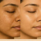 Before and after skin